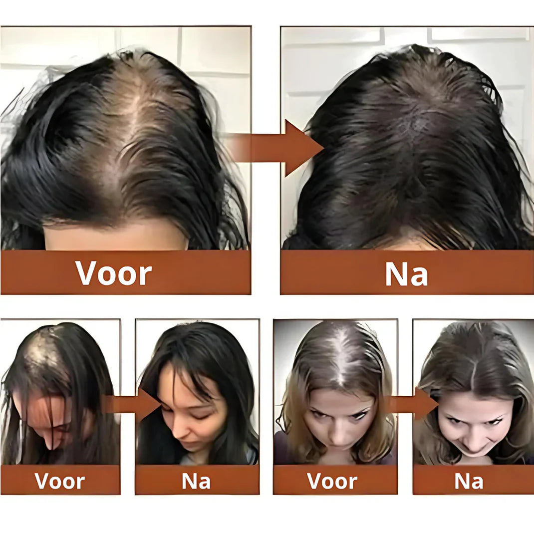 HairHealth™ | Batana Olie voor Natuurlijk Haarherstel