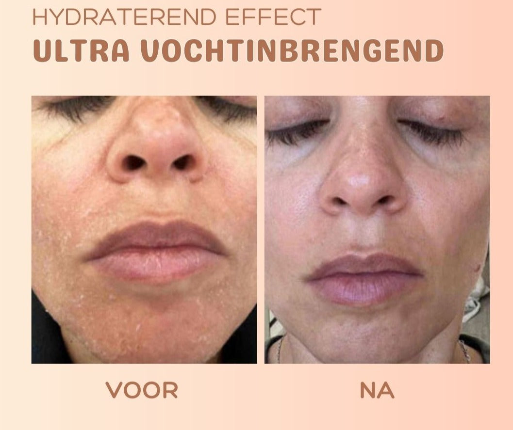 TIJDELIJK 1+1 GRATIS | MultiBalm™ - Anti-rimpel huidvernieuwingsbalsem