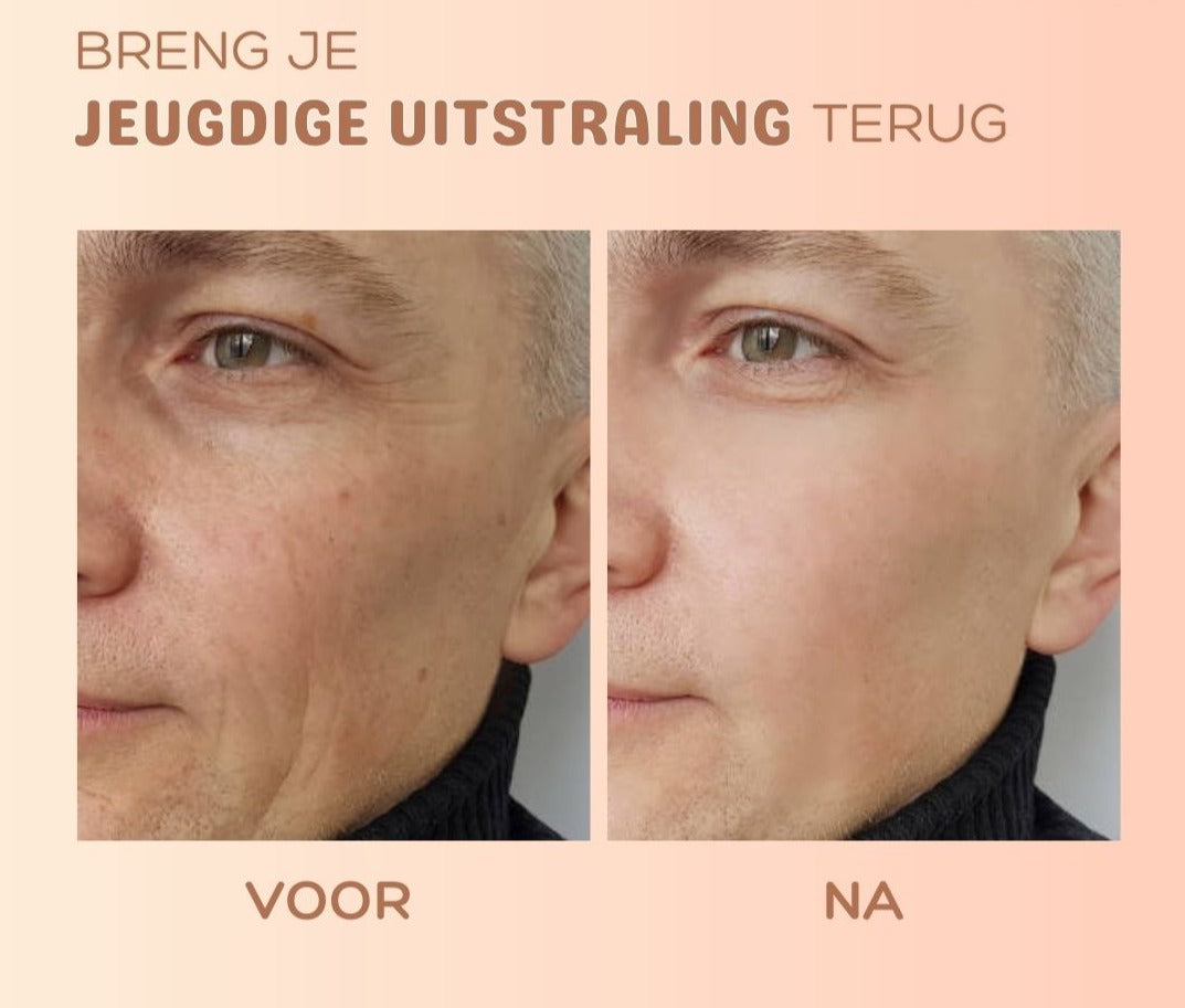 TIJDELIJK 1+1 GRATIS | MultiBalm™ - Anti-rimpel huidvernieuwingsbalsem