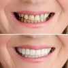 SmileFix™ Créez des dents parfaites | SEULEMENT AUJOURD'HUI 1 + 1 GRATUIT