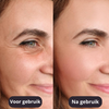 CollagenShine™ - Wateroplosbare anti-rimpel collageen maskers | 5+5 GRATIS