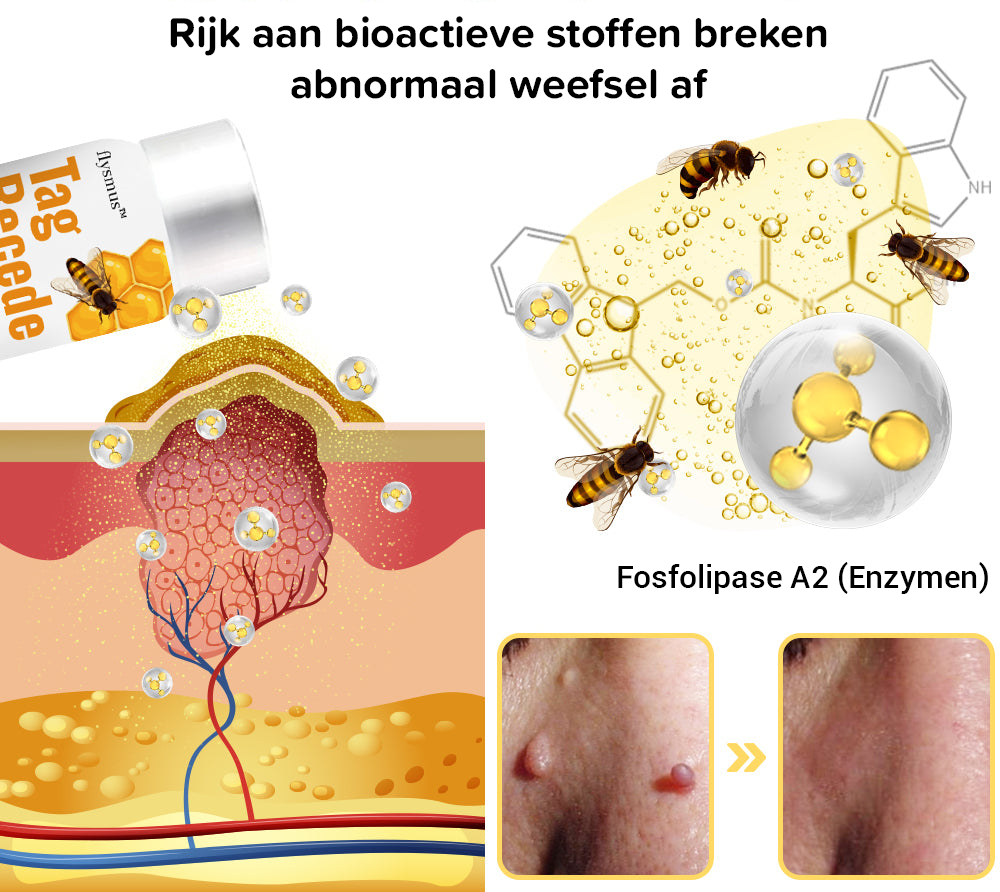 SpotFree - Bijengif Behandelingsspray