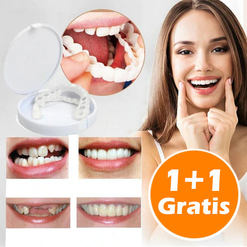 SmileFix™ Creëer het perfecte gebit | ALLEEN VANDAAG 1 + 1 GRATIS