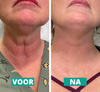 Botox Gezicht Serum™ - 1+1 Gratis!