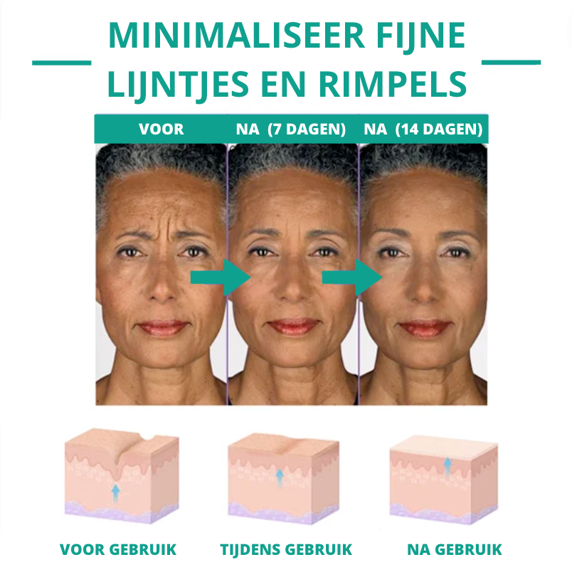 Botox Face Serum™ - ¡1+1 Gratis!