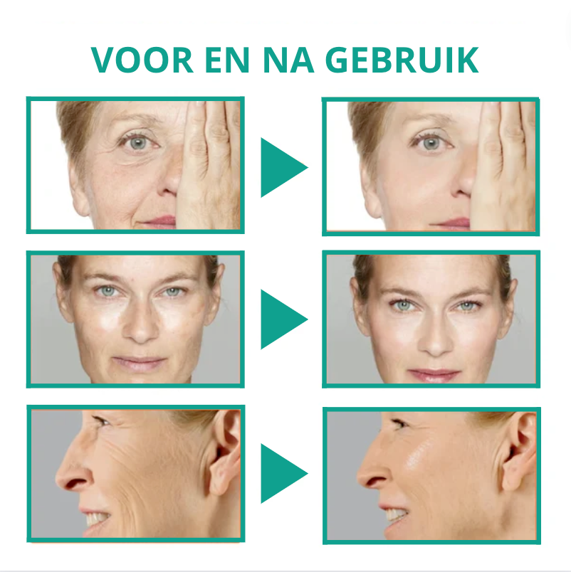 Botox Face Serum™ - ¡1+1 Gratis!