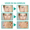 Botox Face Serum™ - 1+1 Gratis!