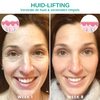 Botox Face Serum™ - 1+1 Gratis!